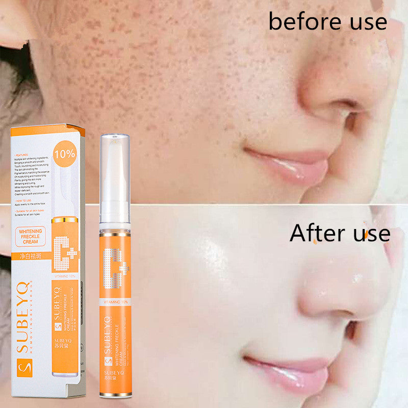 Freckle cream